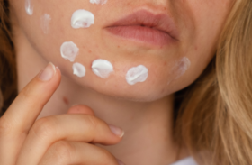 Pickelmale Creme: Finde die Beste Lösung für makellose Haut