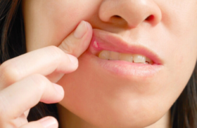 Pickel Lippe Innen