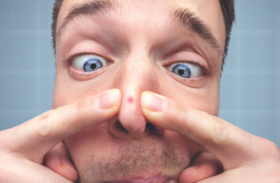 Pickel in der Nase
